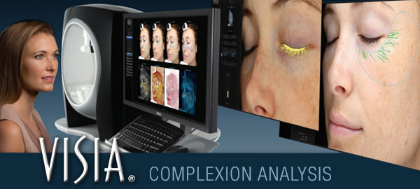 visia skin care complexion analysis