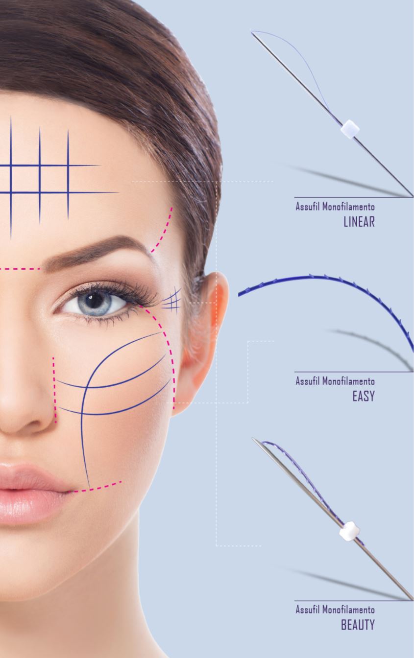 Thread Lifting is the New Facelift! Cosmetique Aesthetics Culver