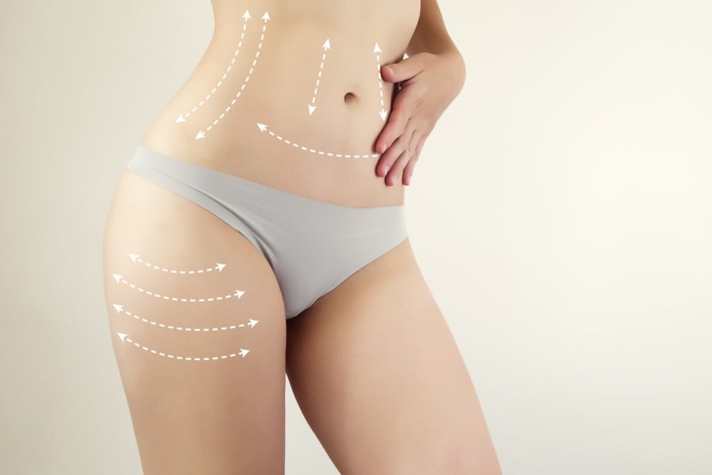what is “lunchtime liposuction”?