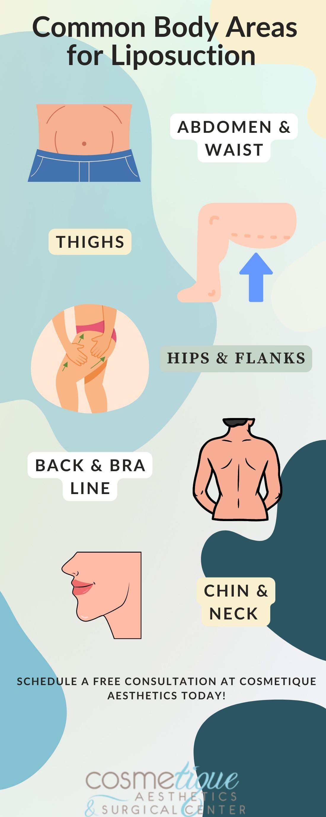 m35972 infographic common body areas for liposuction copy