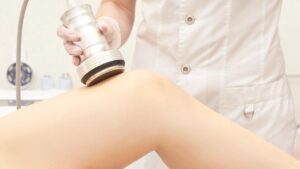 body sculpting procedure