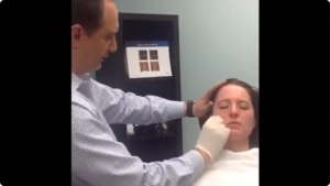 Chemical Peel by Doctor