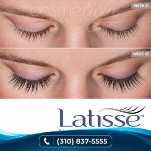 Get Big Bold Lashes