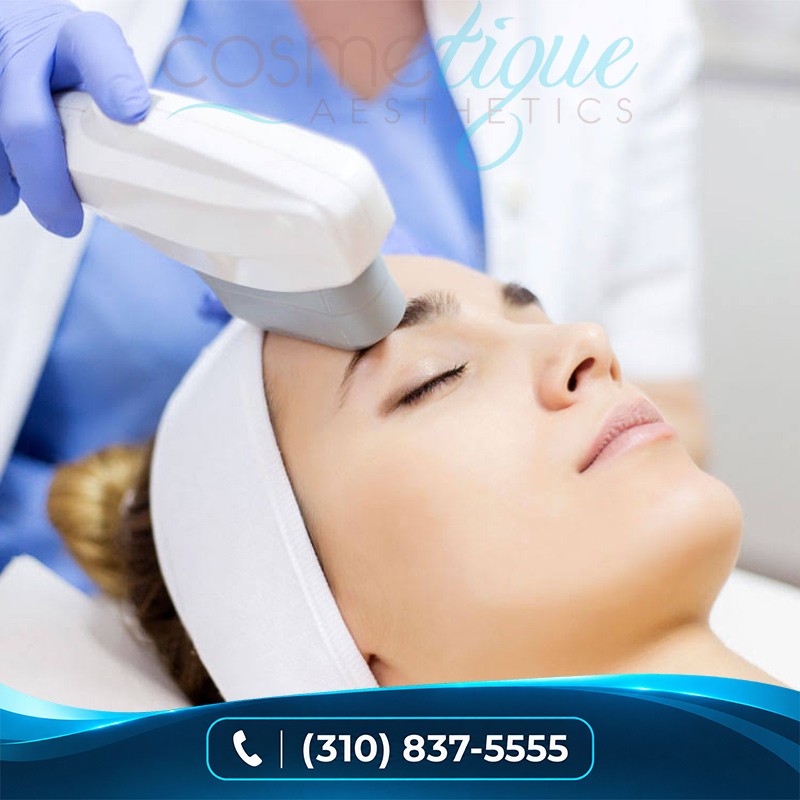 Photorejuvenation/IPL