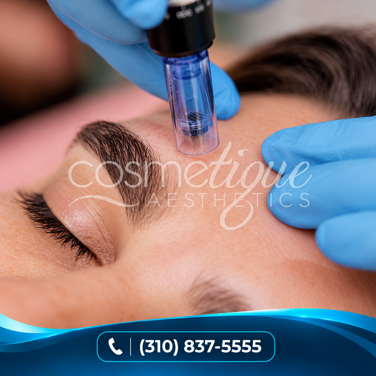 Medical-Grade Microneedling